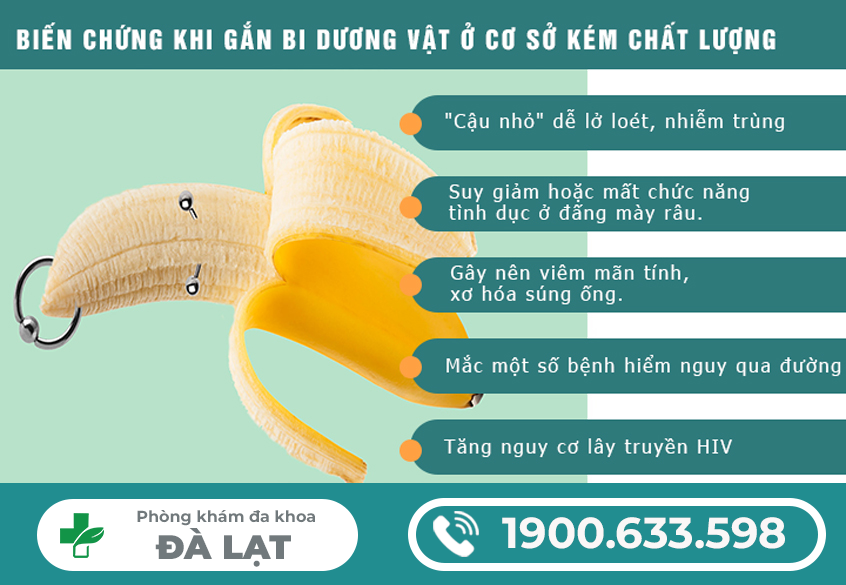 Hình ảnh minh họa